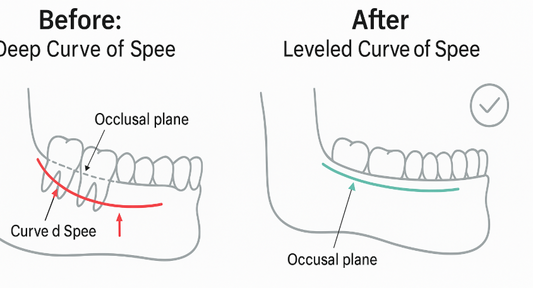 Curve of Spee, Explained in Plain English