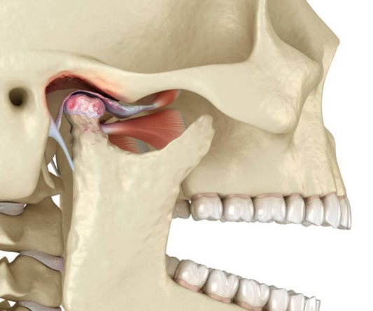 TMJ Relief: Why Traditional Treatments Fail & The Missing Link to Lasting Jaw Pain Relief