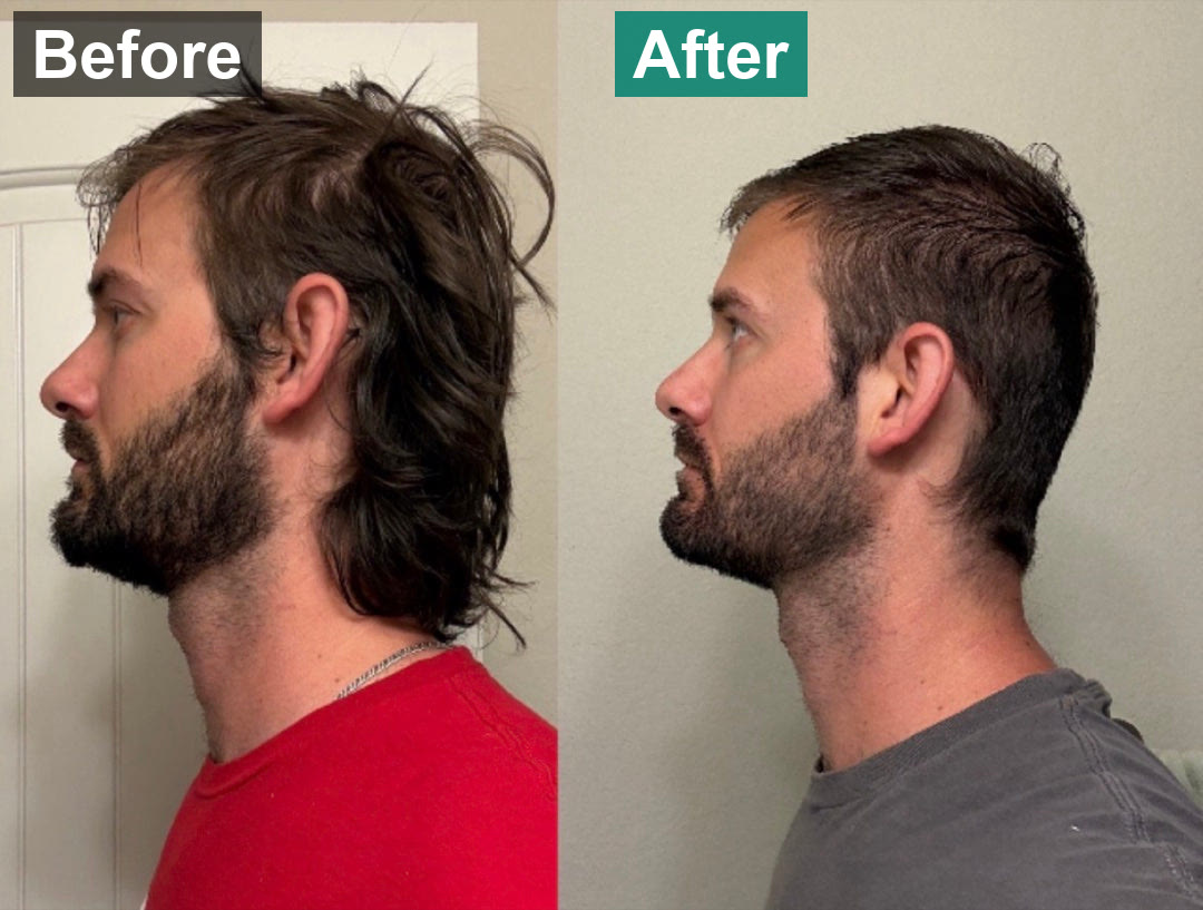 Profile, before and after