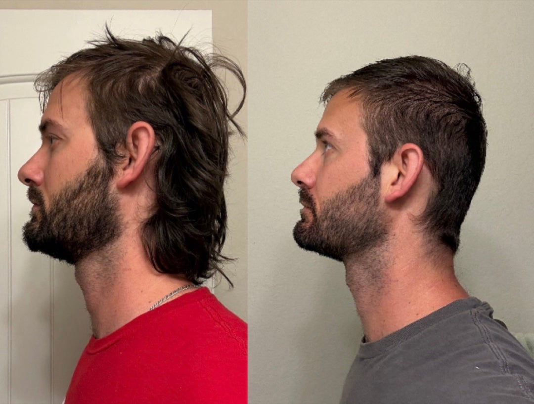 Profile, before and after