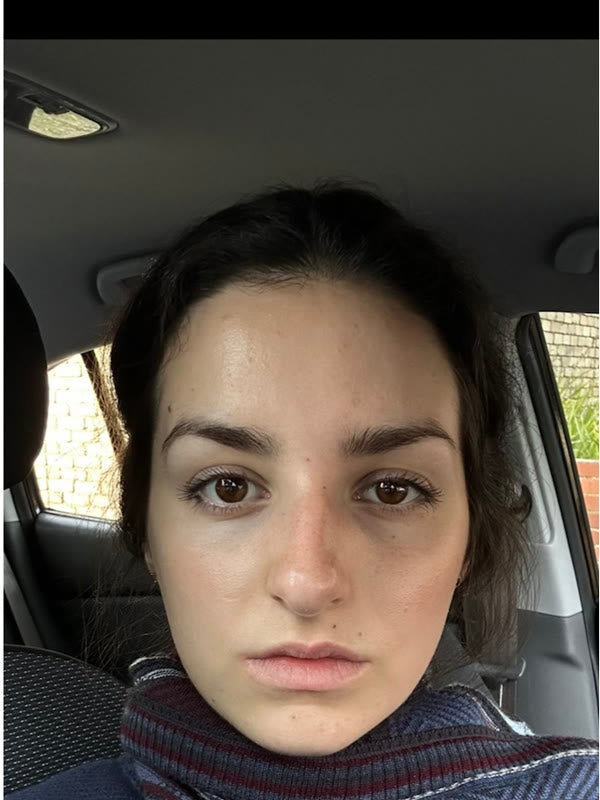 Mia in August 2025