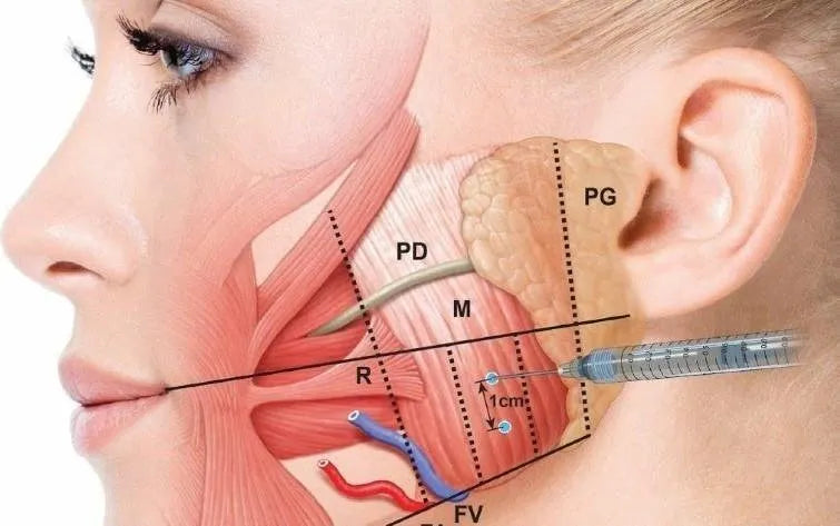 Why I think Botox is absolutely useless