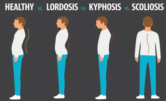 Addressing Lordosis, Kyphosis, & Scoliosis