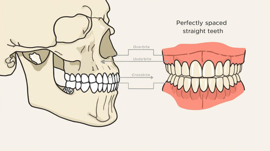 Straight Teeth and Jaw Mechanical Comfort: Understanding the Difference