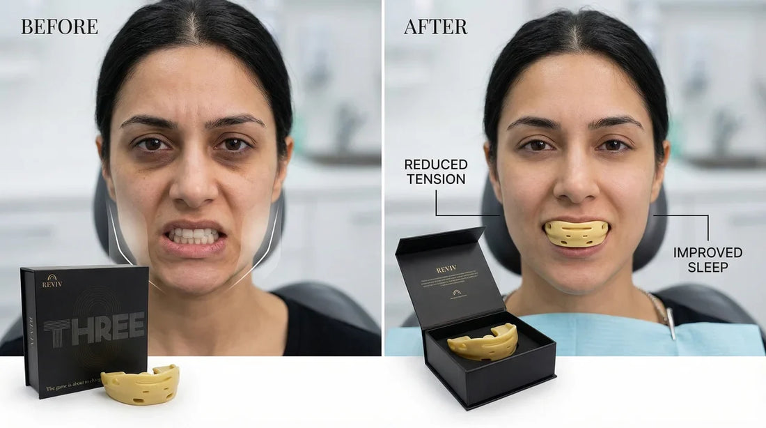 TMJ Mouth Guard Before and After: What Real Results Look Like
