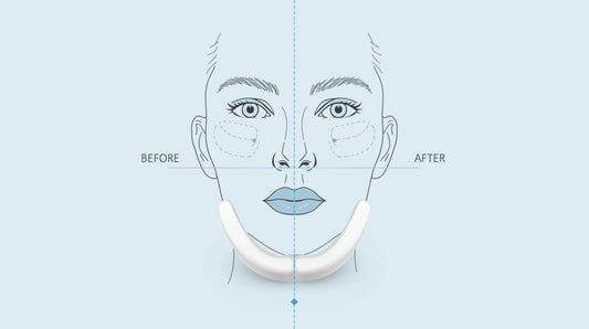 Reviv Mouthguard: The Best Mouthguard for Facial Asymmetry in 2025 [Evidence-Based Guide]