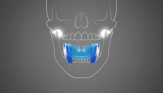 Your Mouth Sleep Guard Isn’t a Sleep Tool. It’s a Jaw Tool.