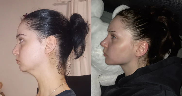Result