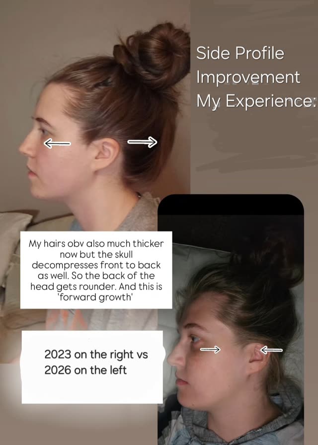 Side profile 2023 vs 2026