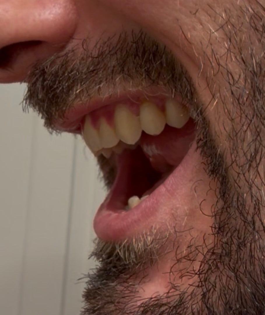 The snaggletooth, closer