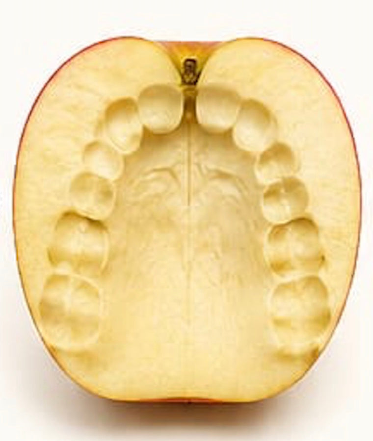 Upper-teeth imprint pressed into the apple flesh